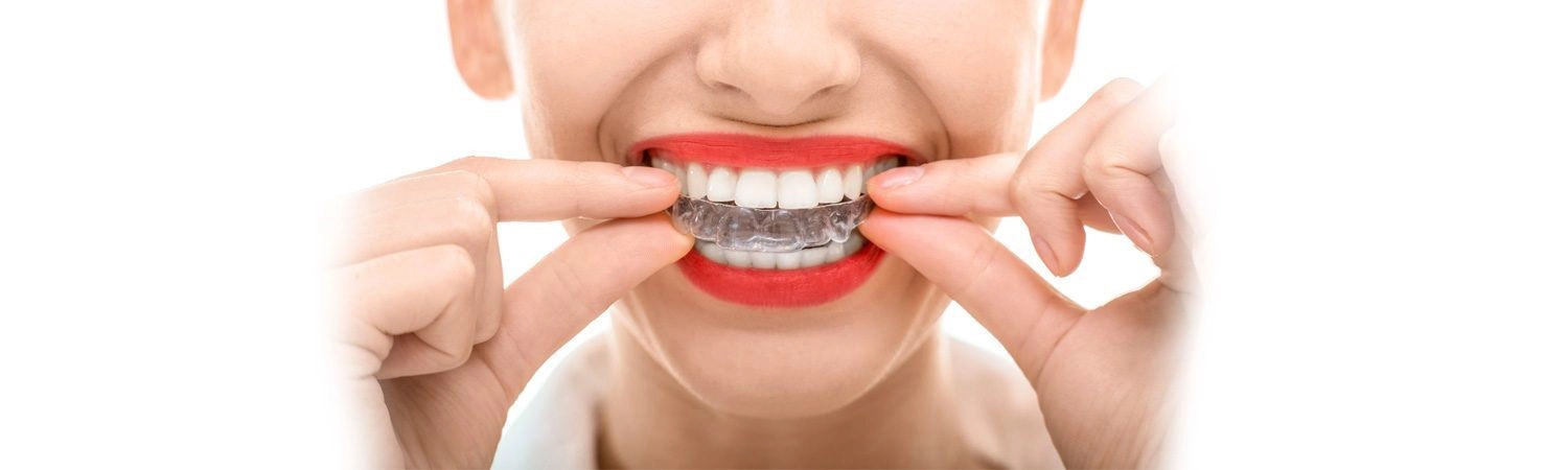 woman with red lipstick putting invisilign retainer in her mouth